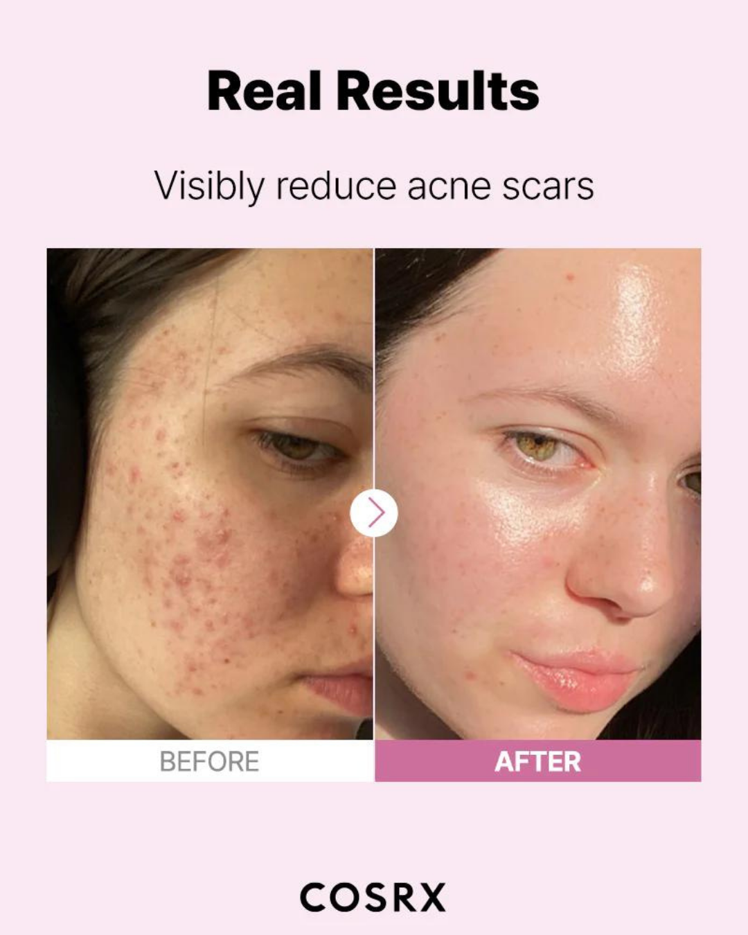 The Niacinamide 15 Serum 20ml