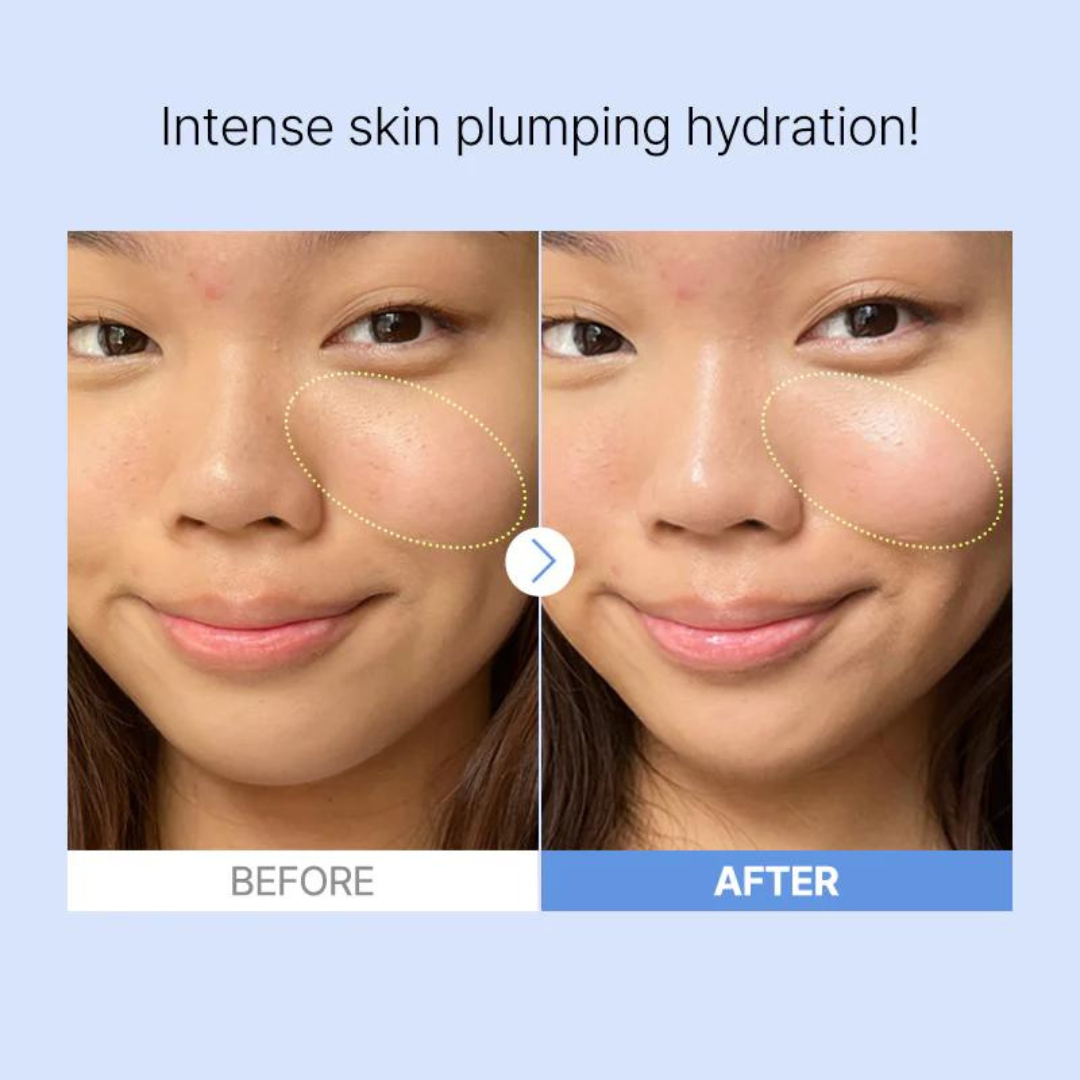 The Hyaluronic Acid 3 Serum 20ml