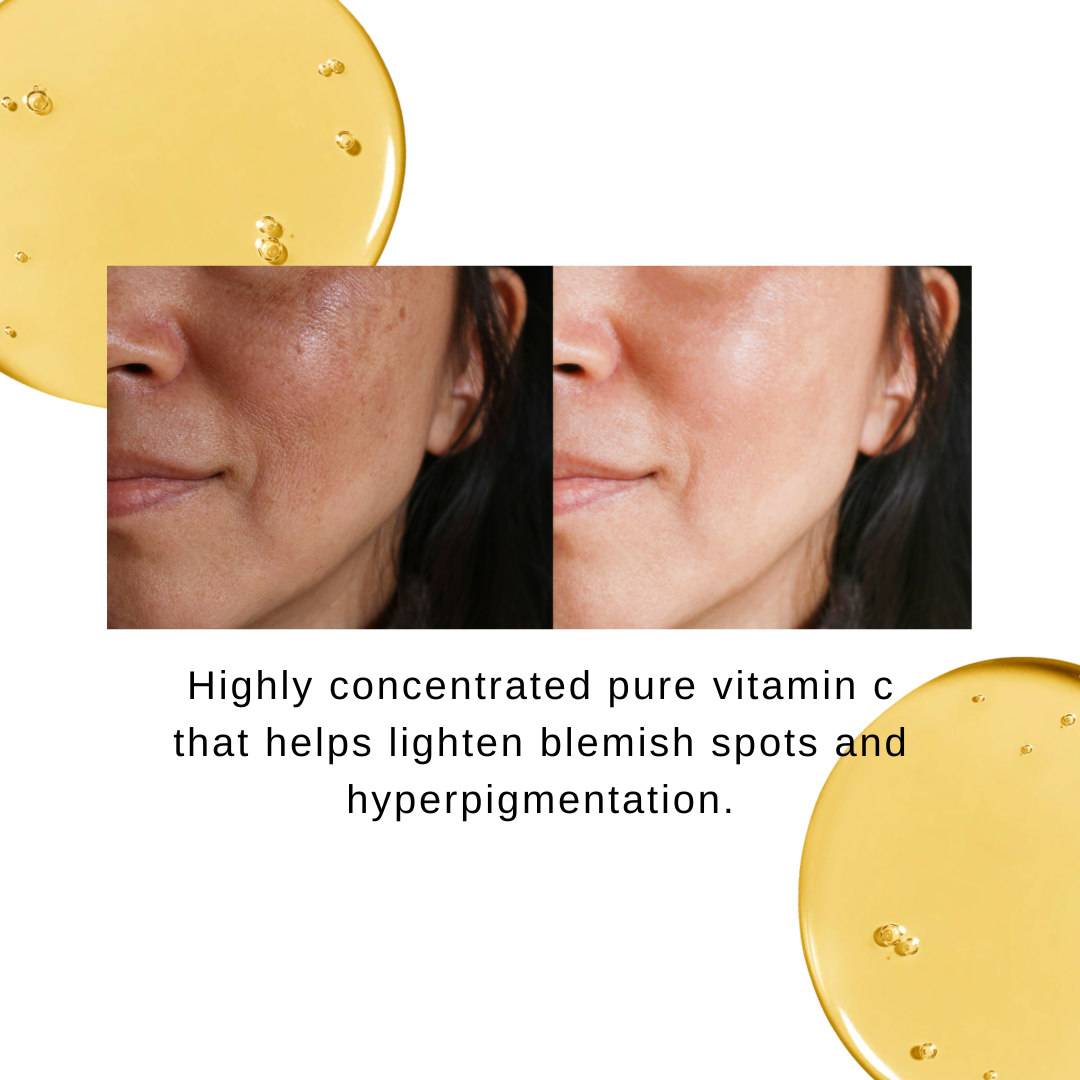 Galactomyces Pure Vitamin C Glow Serum 30ml