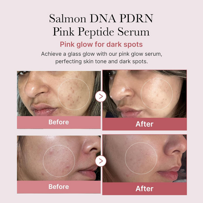 PDRN Pink Peptide Serum 30ml