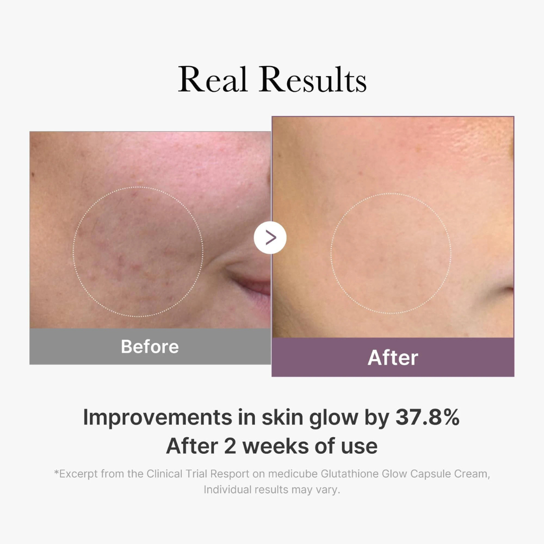 AGE-R Glutathione Glow Capsule Cream 50ml