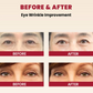 SEOUL 1988 Eye Cream: Retinal Liposome 4% + Fermented Bean 30ml
