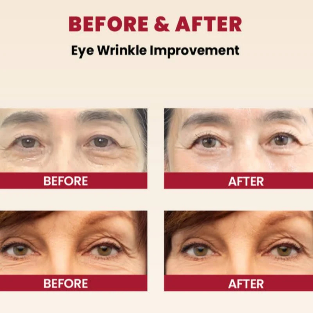 SEOUL 1988 Eye Cream: Retinal Liposome 4% + Fermented Bean 30ml