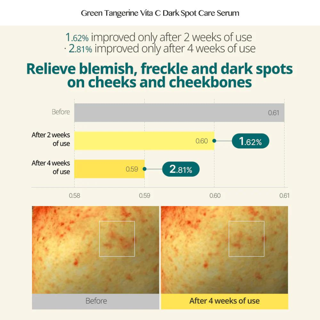 Green Tangerine Vita C Dark Spot Serum 40ml