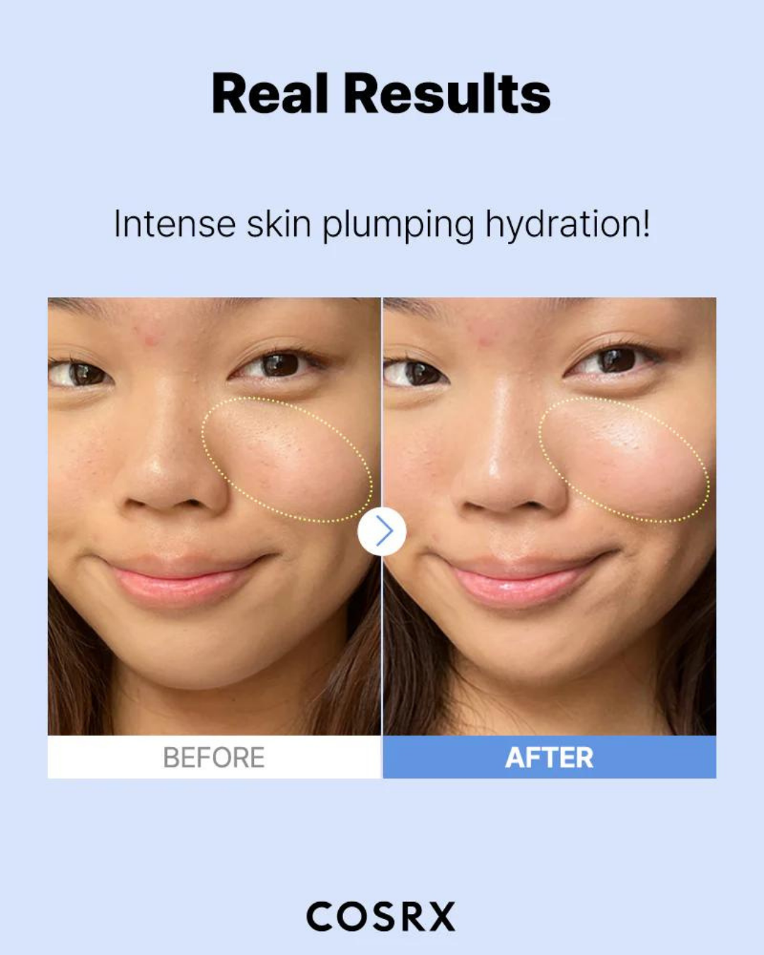 The Hyaluronic Acid 3 Serum 20ml