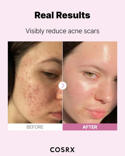 The Niacinamide 15 Serum 20ml
