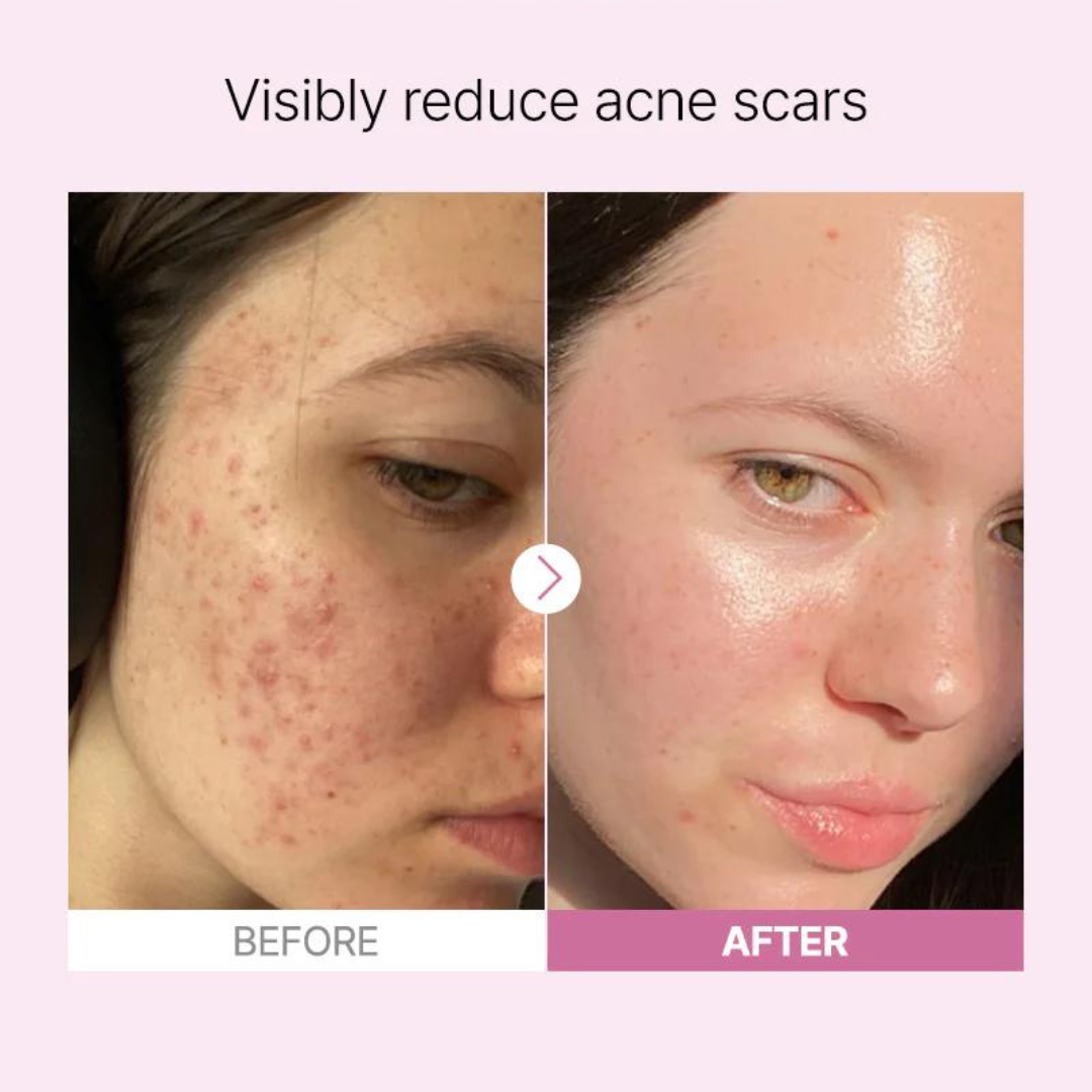 The Niacinamide 15 Serum 20ml