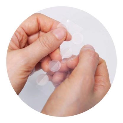 A-Clear Aid Soothing Spot Patch (24 Count, 1 Pack)